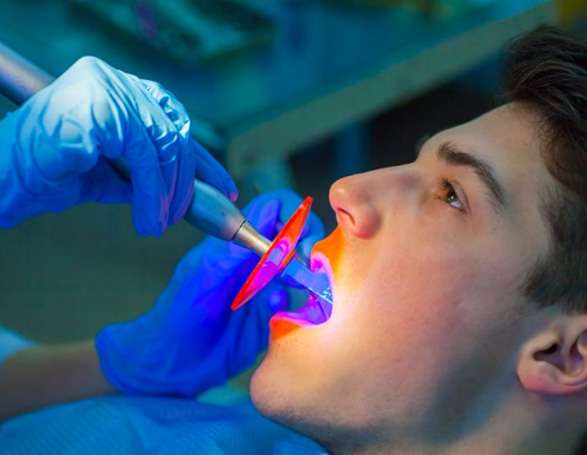 Gloved hands using curing light to harden dental bonding