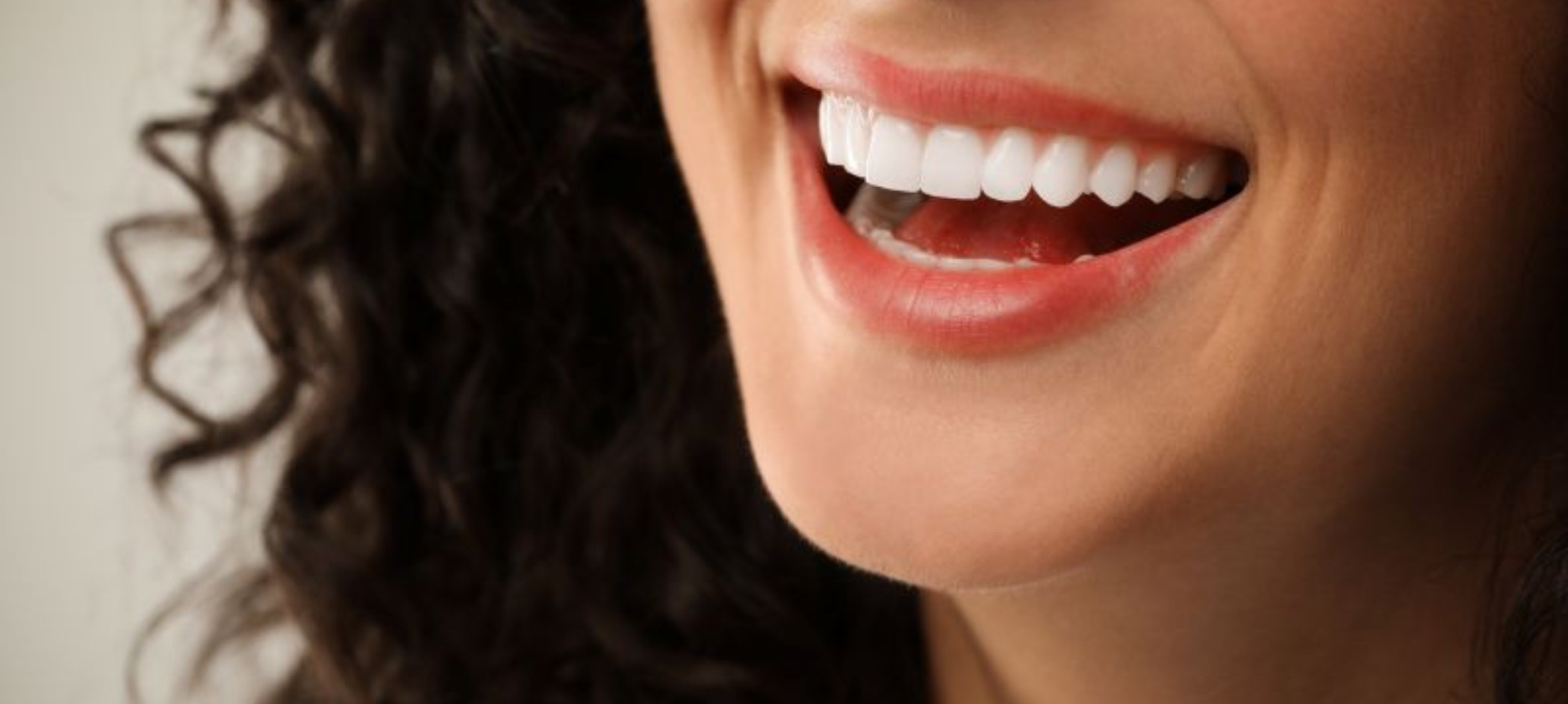 Close-up photo of woman’s perfect teeth after smile makeover