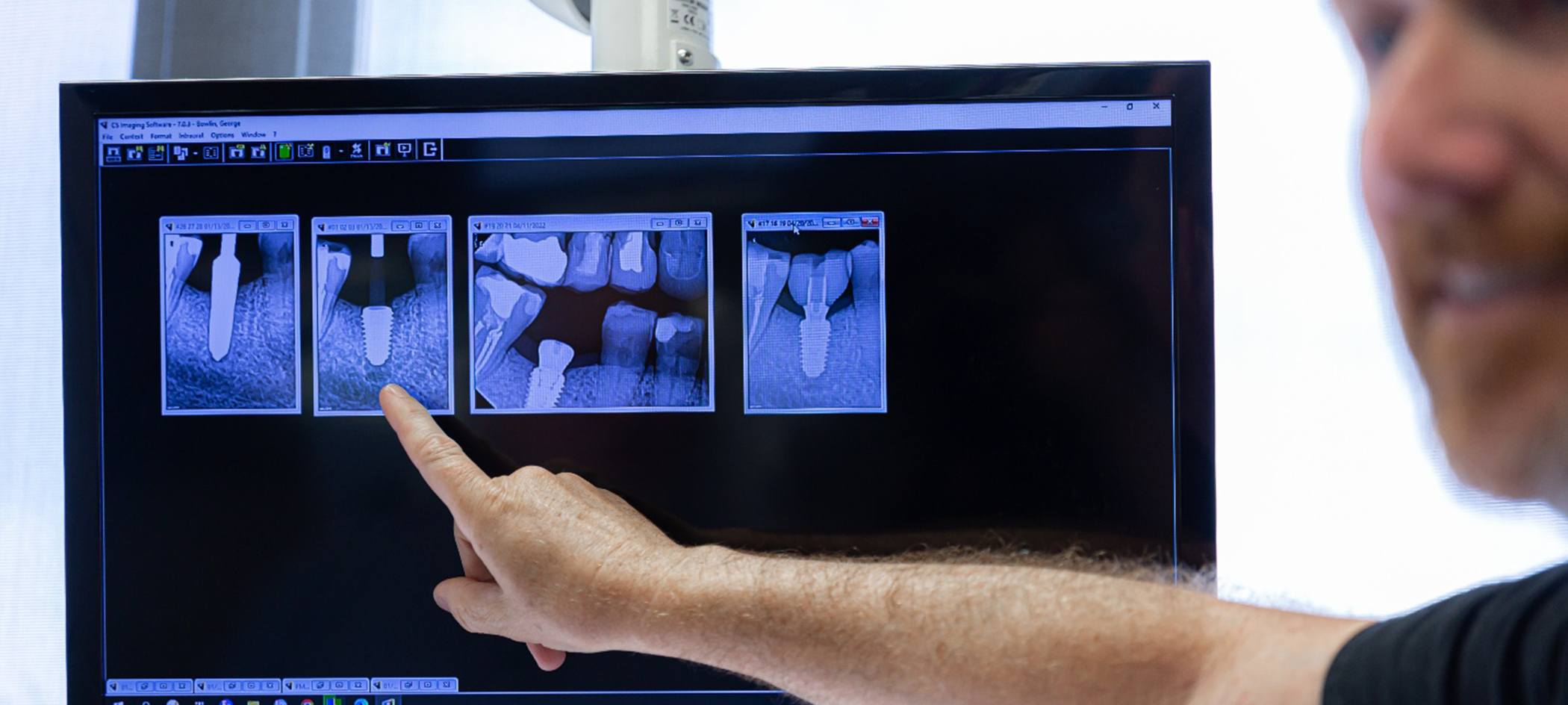Dentist using images on computer monitor to talk about dental implants
